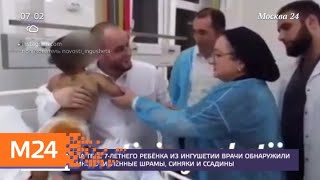 На теле семилетнего ребенка из Ингушетии обнаружили многочисленные шрамы и синяки - Москва 24