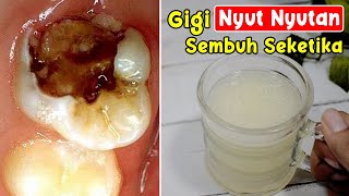CARA PALING AMPUH MENGATASI SAKIT GIGI | GIGI SENUT-SENUT SEMBUH DENGAN CEPAT 