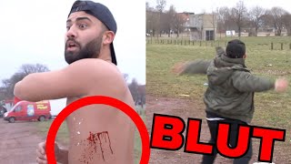 OBERKÖRPERFREI MIT EIER BEWORFEN | ALI
