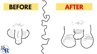 ? Warning: Masturbation Shrinks Your Penis - by Dr Sam Robbins