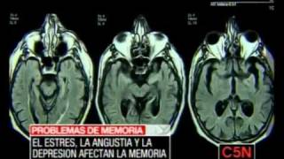 C5N PROBLEMAS DE MEMORIA
