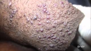 Q4U - Spot Diagnosis