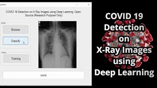 COVID 19 Detection on X Ray Images using Deep Learning