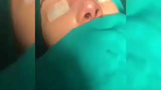 RİNOPLASTİKA LOR CƏRRAH FAİQ ABDULLAYEV