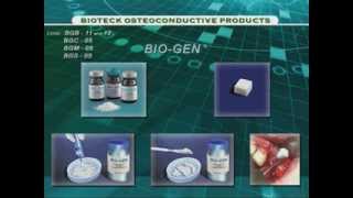 Обзор остеокондуктивных материалов Bioteck
