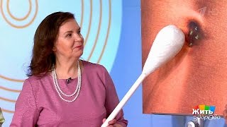 Жить здорово! Про пупок. (28.06.2017)