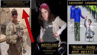 Double Amputee War Story