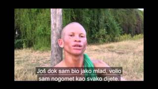 AFRIKANCIJE / albino united