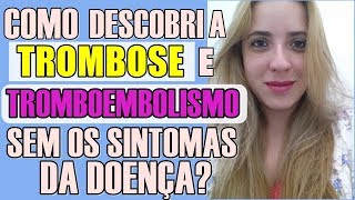 Trombose e Tromboembolismo - Como descobri a doença sem os sintomas #7