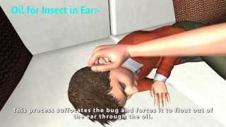 Bug or Insect in Ear Causing Ear Pain? Watch How To Deal With It