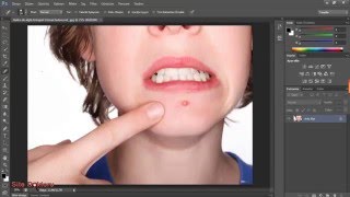 Photoshop ile Sivilce ve Siyah Noktaları Temizleme