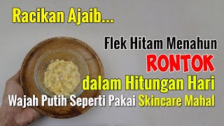 FLEK MENAHUN DI WAJAH HILANG, KULIT PUTIH GLOWING SEPERTI PAKAI SKINCARE MAHAL