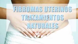 Fibromas Uterinos Tratamientos Naturales 4 Tips Para Tratar la Fibromas Que Nadie Te Dira