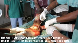 Surgery: Wound Debridement in Kenya