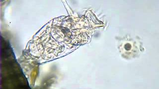 Rotifera
