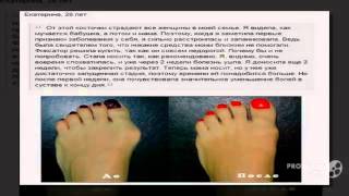 valgus plus производитель

  - Вальгус про недорого купить.