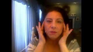 Radiesse - my experience with all the details