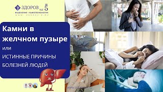 Желчные камни Причины образования камней и болезней людей
